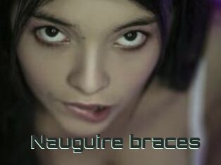 Nauguire_braces